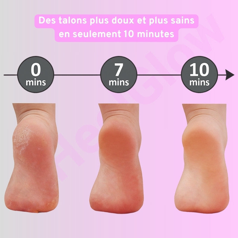 GlowStep™ – Smooth Feet Made Easy (Last Day Sale)