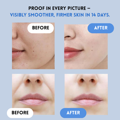 DermaLift™ Bandes Lissantes pour la Peau