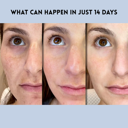 DermaLift™ Bandes Lissantes pour la Peau