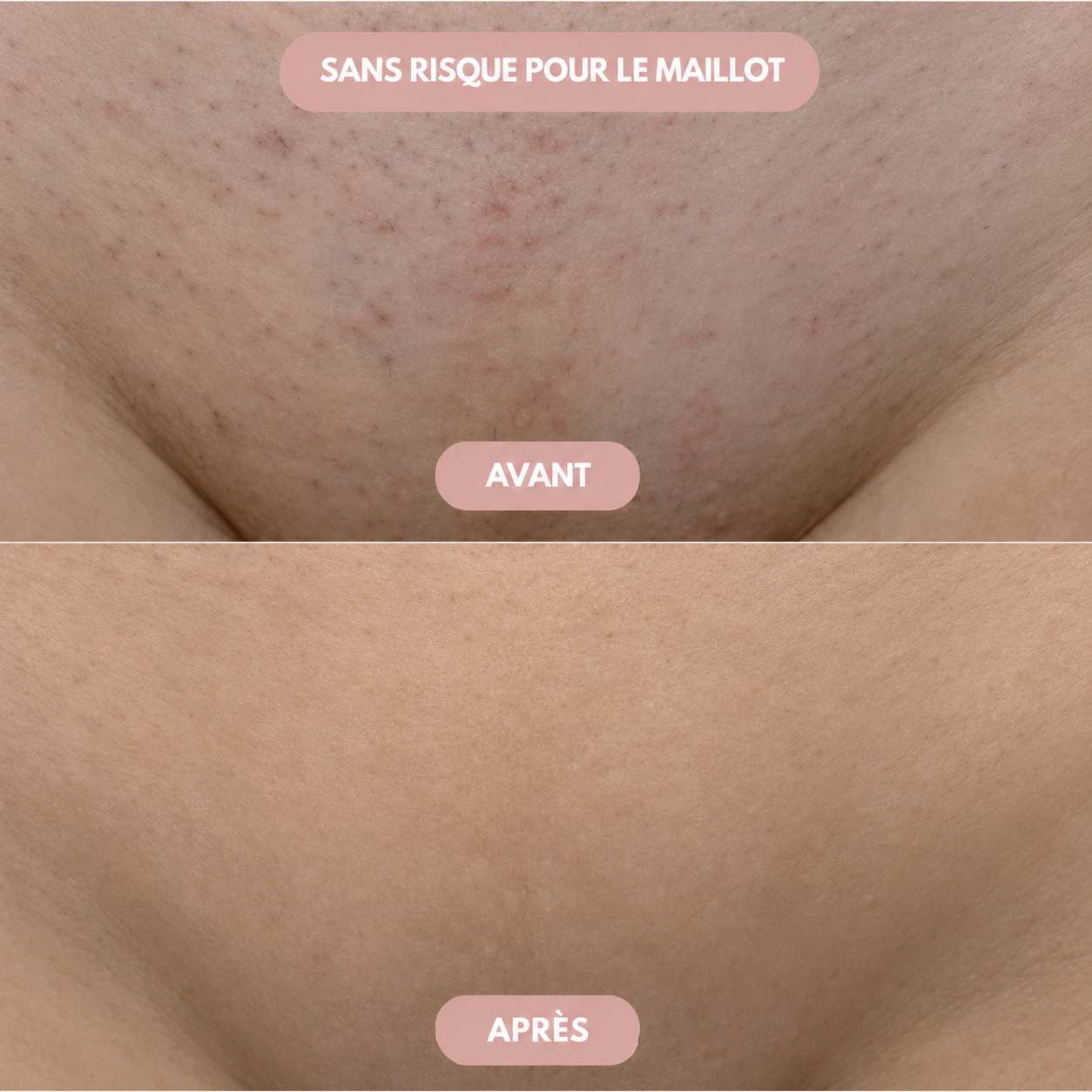 VelvetShave™ – Le Rasoir Féminin Sans Coupures Ni Irritations – 50% OFF